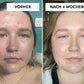 LEDEXIA - Die LED Maske für strahlende junge Haut