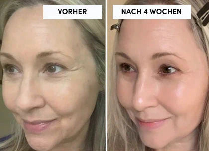 LEDEXIA - Die LED Maske für strahlende junge Haut